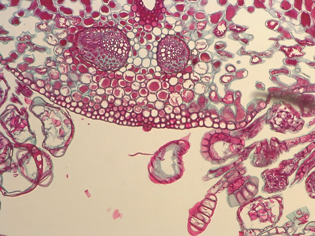 Mature Sporangia Slides - Mature Sporangia 02 100X
